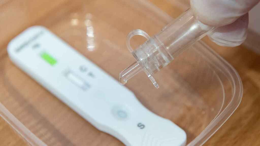 Imagen de una prueba con test de antígenos.